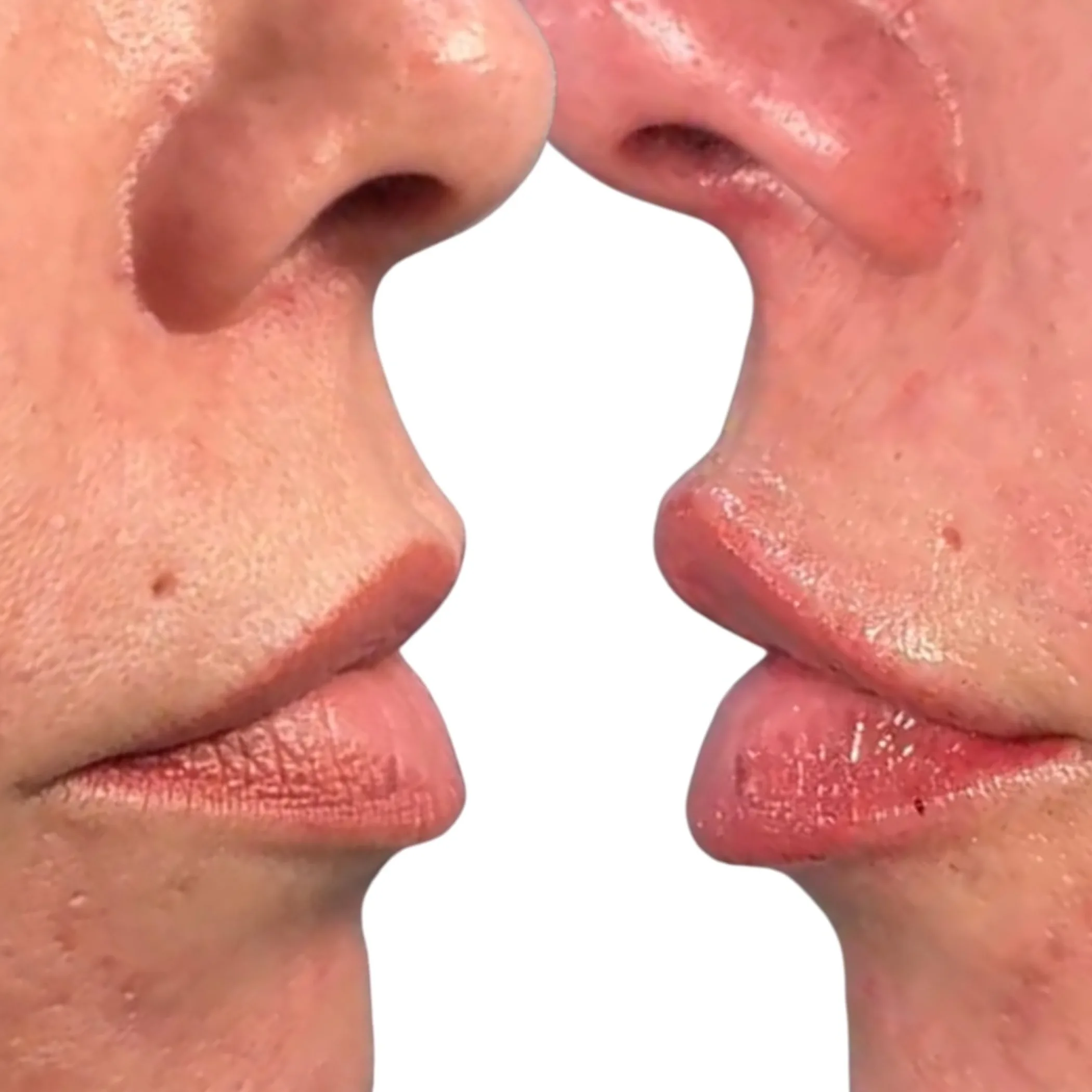 facial features for cosmetic injectables