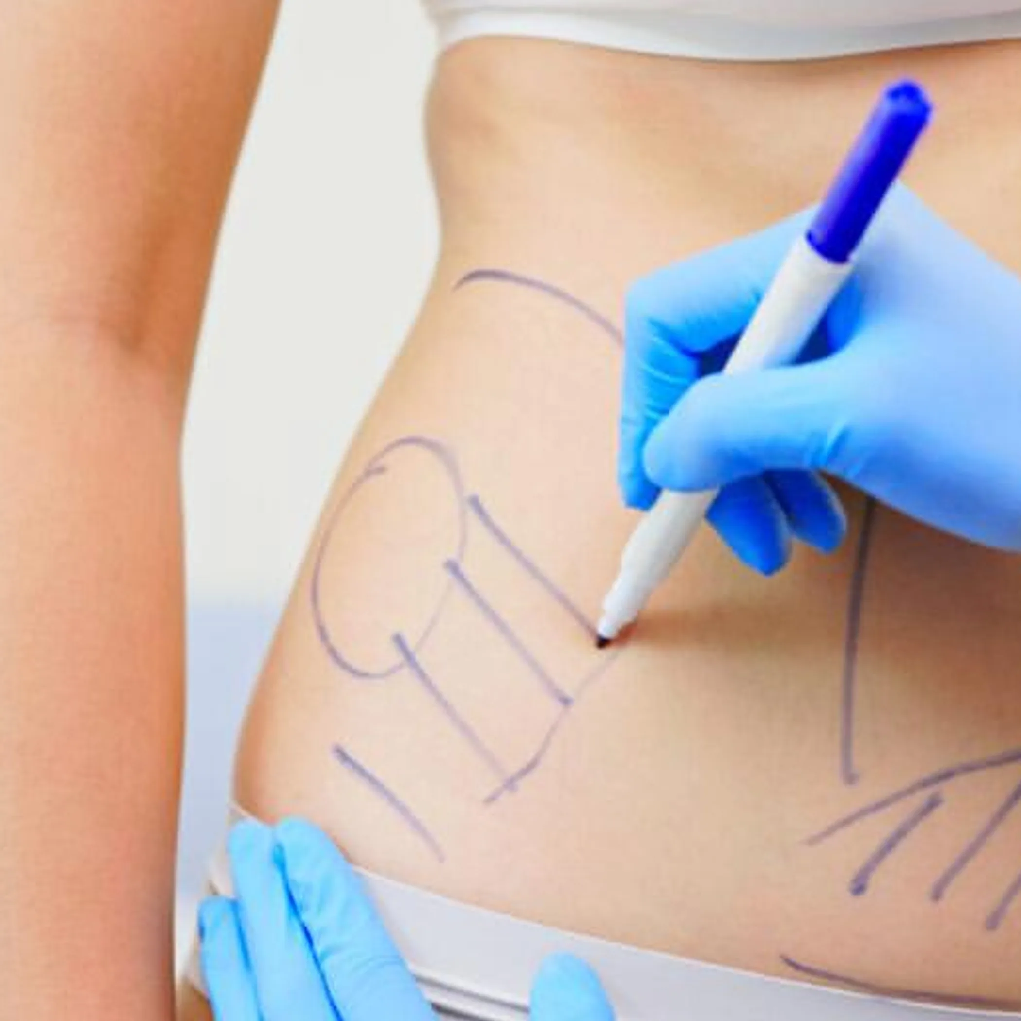 cosmetic procedure preparation setup